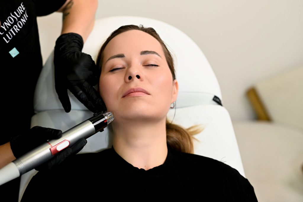 woman receives rf microneedling treatment in Arnprior Ontario