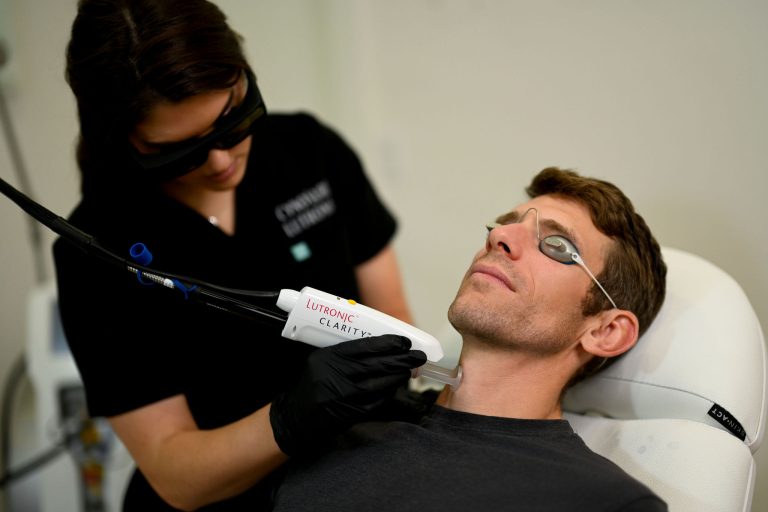 man receiving laser vascular treatment