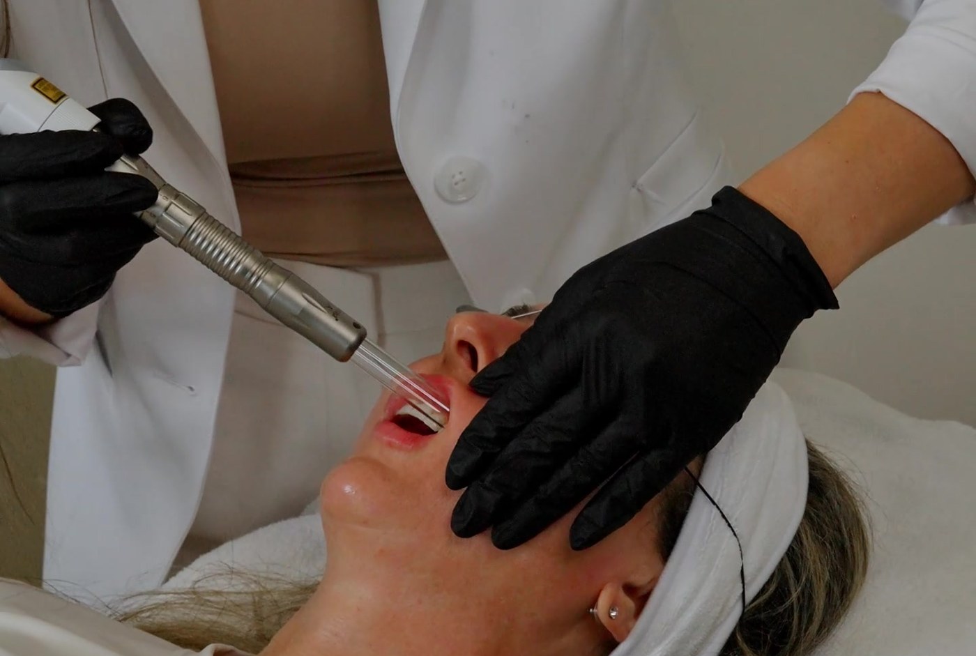 Stacey performing a Fotona 4D SmoothLifting pass at Arnprior Med Spa