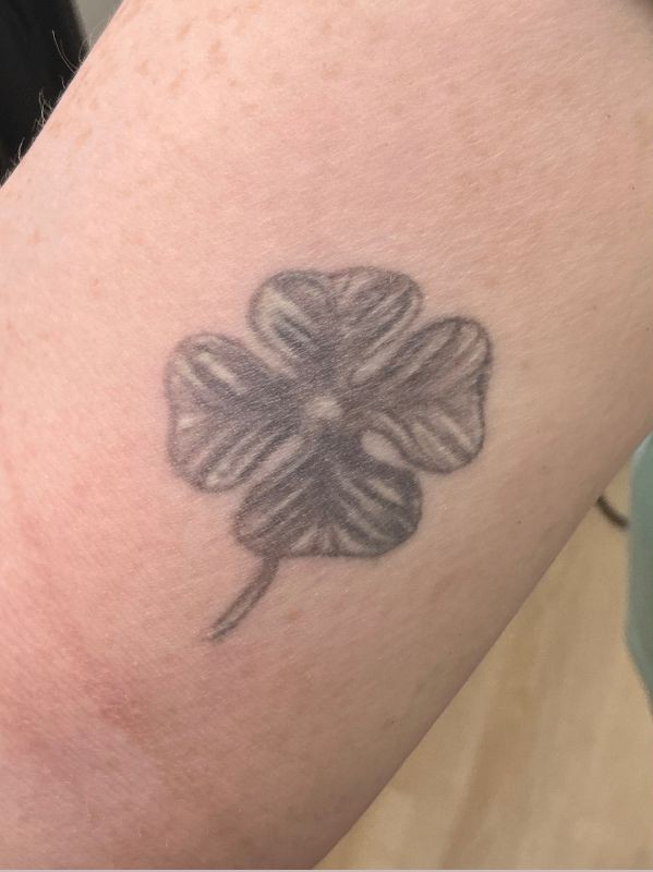 Tattoo Removal After 4 Sessions on Arm, before
